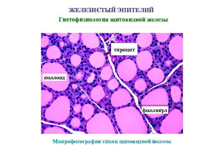 ЖЕЛЕЗИСТЫЙ ЭПИТЕЛИЙ Гистофизиология щитовидной железы тироцит коллоид фолликул Микрофотография ткани щитовидной железы 