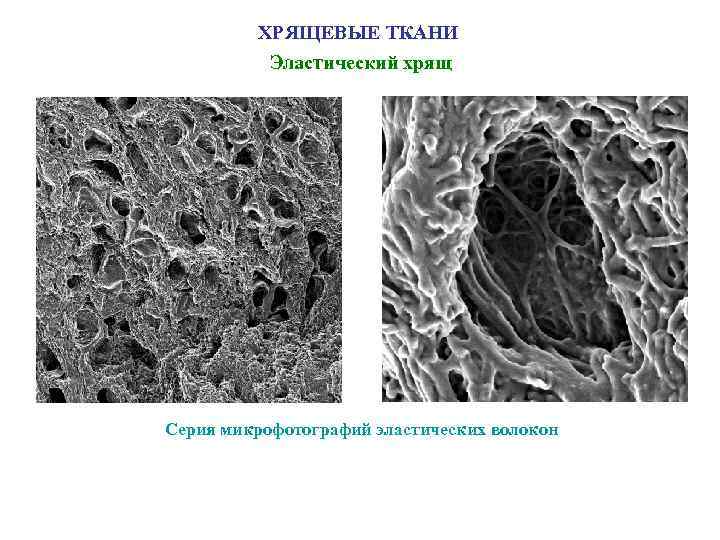 ХРЯЩЕВЫЕ ТКАНИ Эластический хрящ Серия микрофотографий эластических волокон 