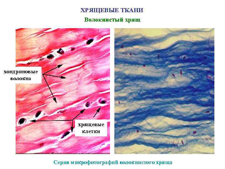 Хрящевые ткани рисунок