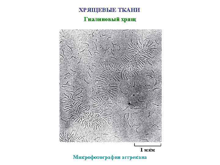ХРЯЩЕВЫЕ ТКАНИ Гиалиновый хрящ 1 мкм Микрофотография аггрекана 