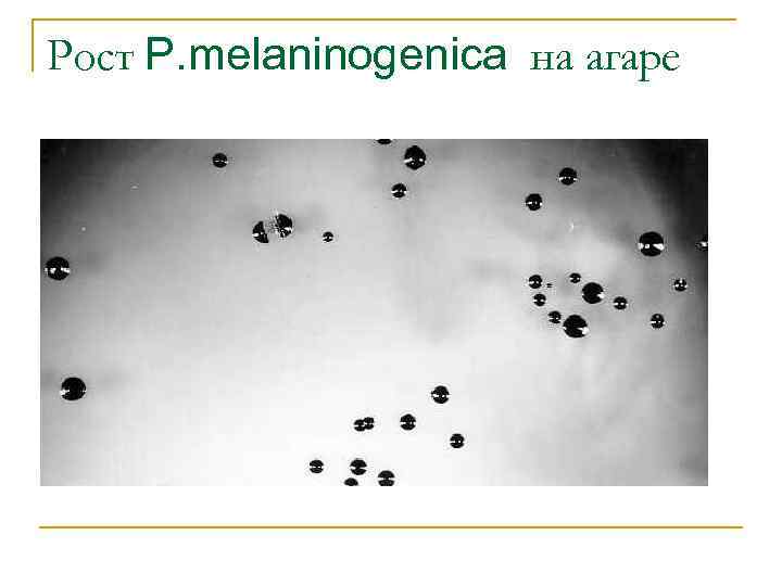 Рост P. melaninogenica на агаре 