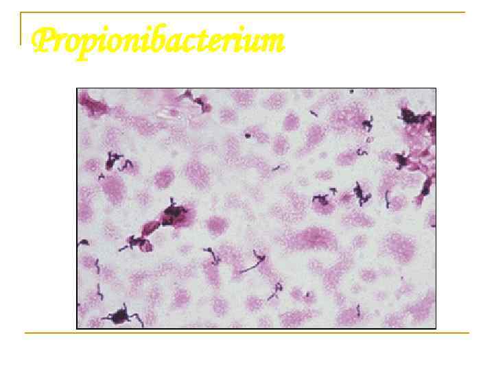 Propionibacterium 