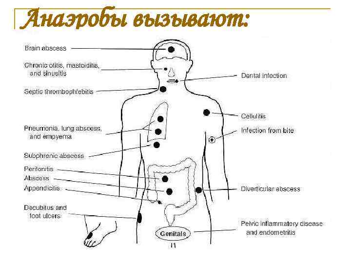 Анаэробы вызывают: 