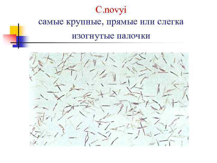 C. novyi самые крупные, прямые или слегка изогнутые палочки 