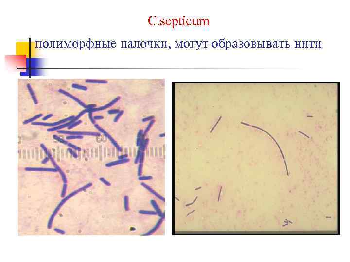 C. septicum полиморфные палочки, могут образовывать нити 