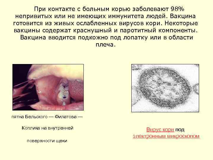  При контакте с больным корью заболевают 98% непривитых или не имеющих иммунитета людей.