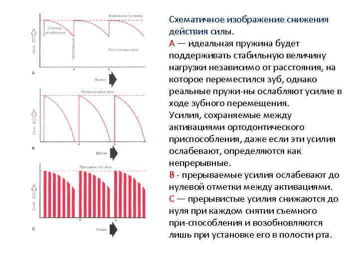 Схематичное изображение снижения действия силы. А — идеальная пружина будет поддерживать стабильную величину нагрузки