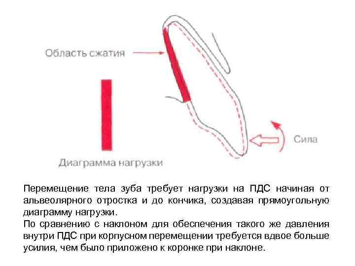 Перемещение тела зуба требует нагрузки на ПДС начиная от альвеолярного отростка и до кончика,