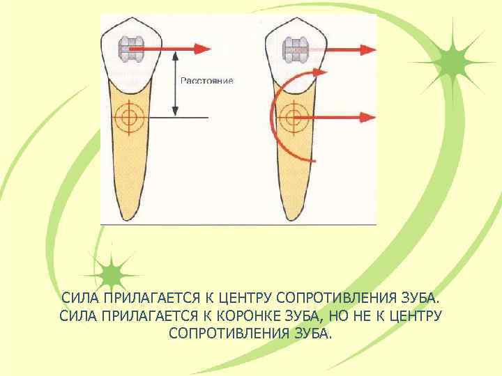 Биомеханика в ортодонтии презентация