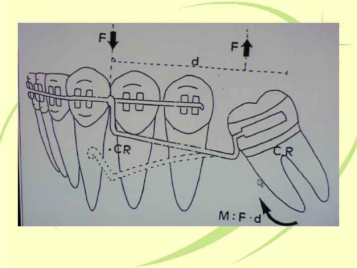 Биомеханика в ортодонтии презентация