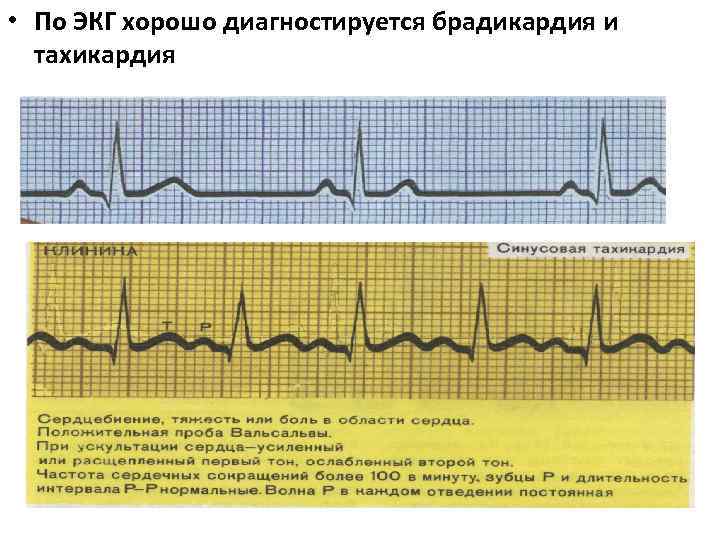 Задание экг