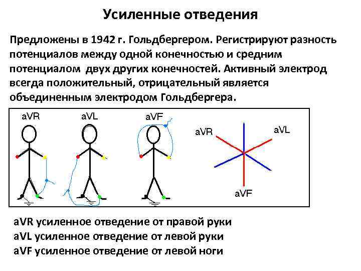 Усиленные отведения экг схема