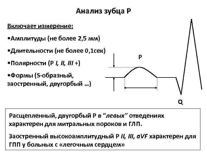 Амплитуда q. Амплитуда и Продолжительность зубцов ЭКГ. Амплитуда зубцов r ЭКГ. Амплитуда зубца ЭКГ X = 10 мм/МВ. Амплитуда зубца т в норме на ЭКГ мм.