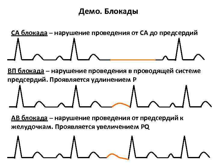 Са блокада