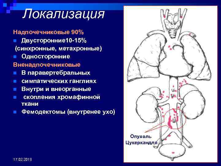 Локализация Надпочечниковые 90% n Двусторонние 10 -15% (синхронные, метахронные) n Односторонние Вненадпочечниковые n В