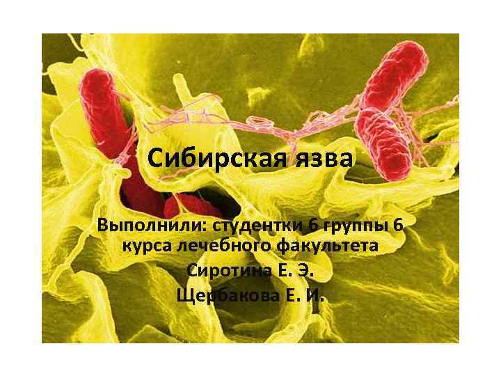 Сибирская язва Выполнили: студентки 6 группы 6 курса лечебного факультета Сиротина Е. Э. Щербакова