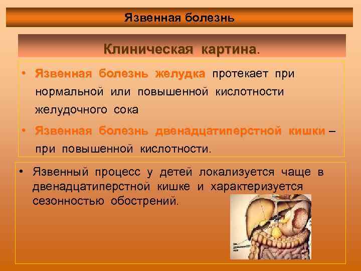 Язвенная болезнь Клиническая картина • Язвенная болезнь желудка протекает при нормальной или повышенной кислотности