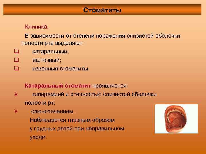 Стоматиты Клиника. В зависимости от степени поражения слизистой оболочки полости рта выделяют: q катаральный;