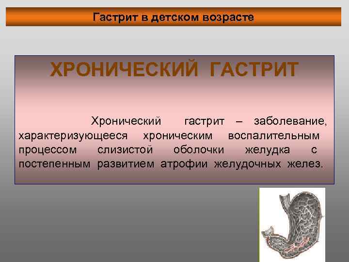 Гастрит в детском возрасте ХРОНИЧЕСКИЙ ГАСТРИТ Хронический гастрит – заболевание, характеризующееся хроническим воспалительным процессом