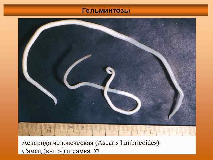 Гельминтозы 