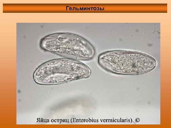 Гельминтозы 