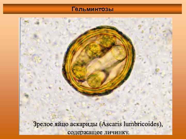 Гельминтозы 