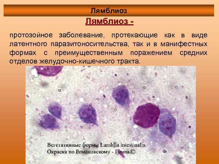 Лямблиоз протозойное заболевание, протекающие как в виде латентного паразитоносительства, так и в манифестных формах