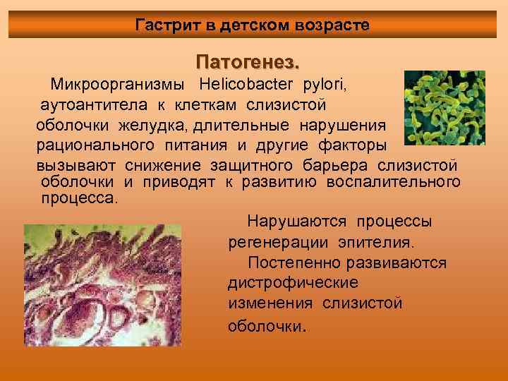Гастрит в детском возрасте Патогенез. Микроорганизмы Helicobacter pylori, аутоантитела к клеткам слизистой оболочки желудка,