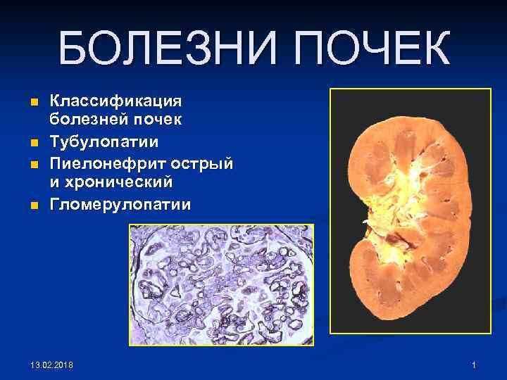 БОЛЕЗНИ ПОЧЕК n n Классификация болезней почек Тубулопатии Пиелонефрит острый и хронический Гломерулопатии 13.