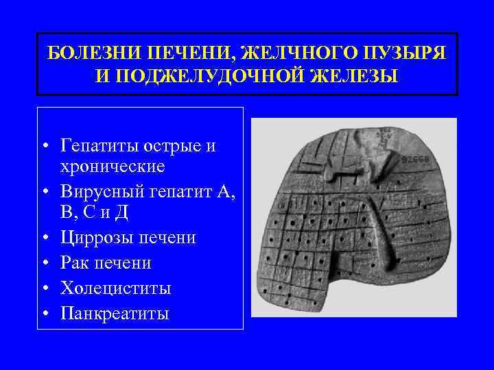 БОЛЕЗНИ ПЕЧЕНИ, ЖЕЛЧНОГО ПУЗЫРЯ И ПОДЖЕЛУДОЧНОЙ ЖЕЛЕЗЫ • Гепатиты острые и хронические • Вирусный