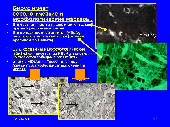 Вирус имеет серологические и морфологические маркеры. • • Его частицы видны в ядре и
