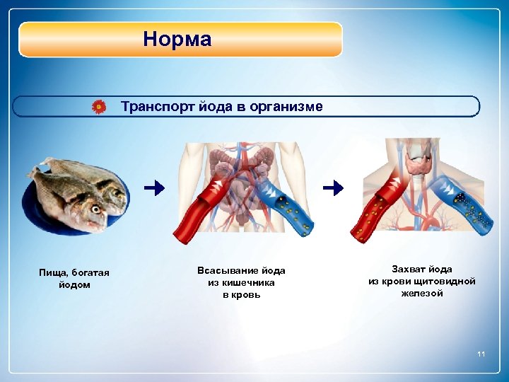 Норма Транспорт йода в организме Пища, богатая йодом Всасывание йода из кишечника в кровь