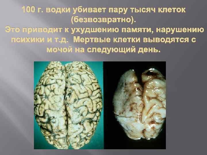 100 г. водки убивает пару тысяч клеток (безвозвратно). Это приводит к ухудшению памяти, нарушению