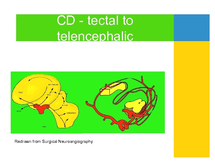 CD - tectal to telencephalic Redrawn from Surgical Neuroangiography 