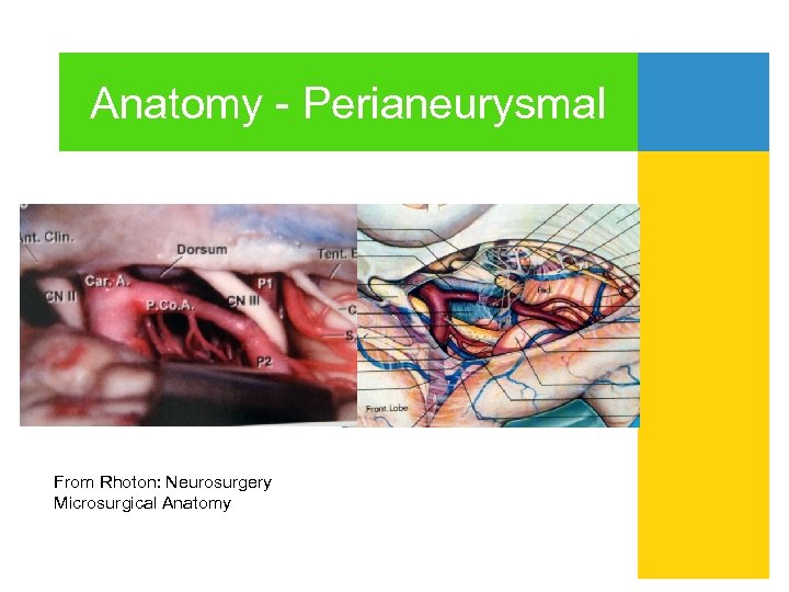 Anatomy - Perianeurysmal From Rhoton: Neurosurgery Microsurgical Anatomy 