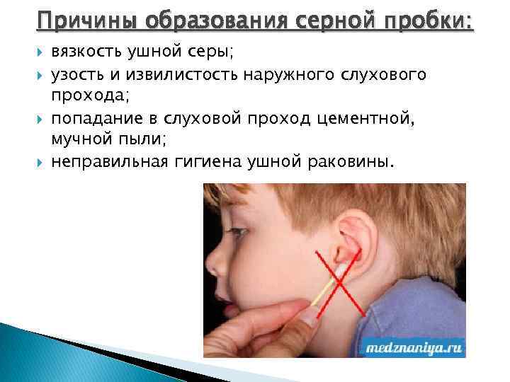 Причины образования серной пробки: вязкость ушной серы; узость и извилистость наружного слухового прохода; попадание