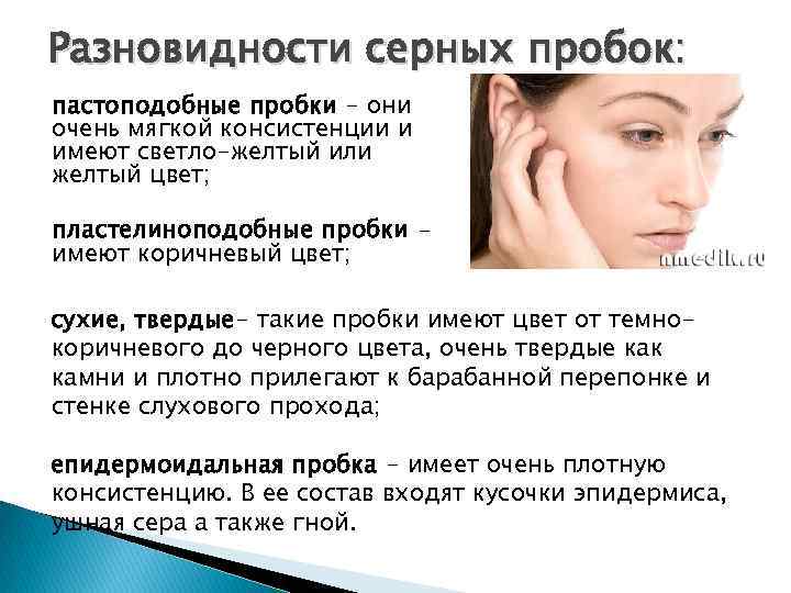 Разновидности серных пробок: пастоподобные пробки - они очень мягкой консистенции и имеют светло-желтый или