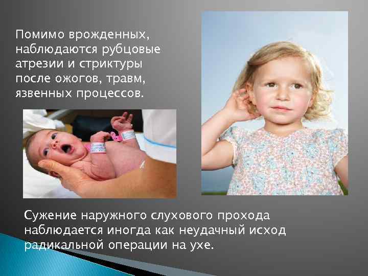 Помимо врожденных, наблюдаются рубцовые атрезии и стриктуры после ожогов, травм, язвенных процессов. Сужение наружного