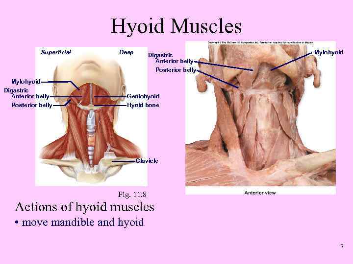 Hyoid Muscles Superficial Deep Digastric Anterior belly Mylohyoid Posterior belly Mylohyoid Digastric Anterior belly