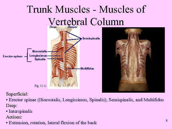 Trunk Muscles - Muscles of Vertebral Column Deeper Semispinalis Erector spinae Iliocostalis Longissimus Spinalis