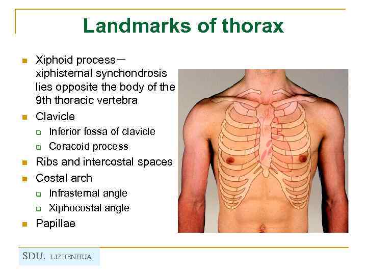 Landmarks of thorax n n Xiphoid process－ xiphisternal synchondrosis lies opposite the body of