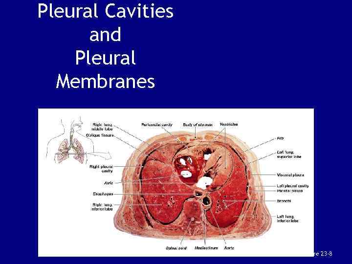 Pleural Cavities and Pleural Membranes Figure 23– 8 