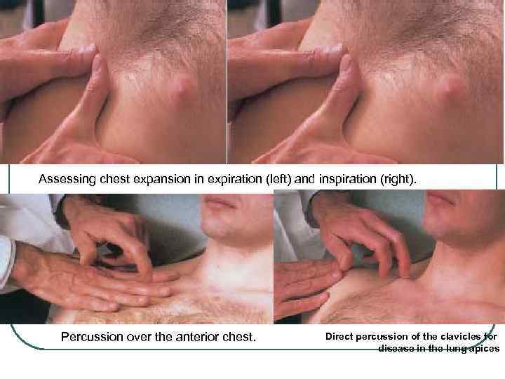 Assessing chest expansion in expiration (left) and inspiration (right). Percussion over the anterior chest.