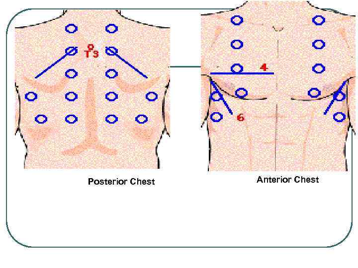 Posterior Chest Anterior Chest 