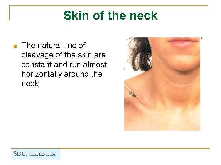 Skin of the neck n The natural line of cleavage of the skin are