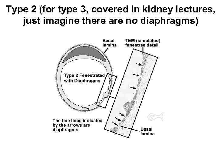 Type 2 (for type 3, covered in kidney lectures, just imagine there are no