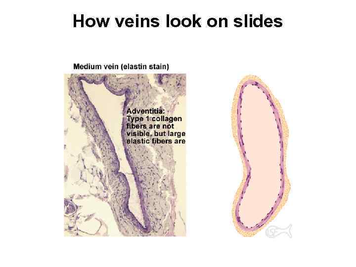 How veins look on slides 