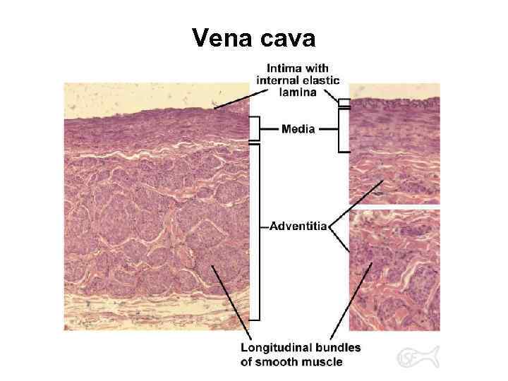 Vena cava 