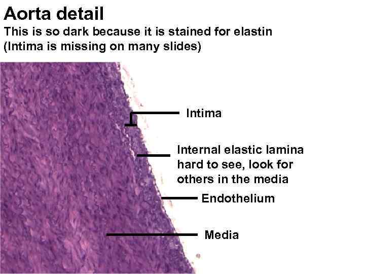 Aorta detail This is so dark because it is stained for elastin (Intima is