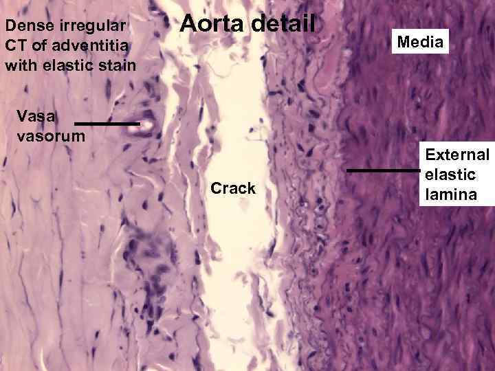 Dense irregular CT of adventitia with elastic stain Aorta detail Media Vasa vasorum Crack